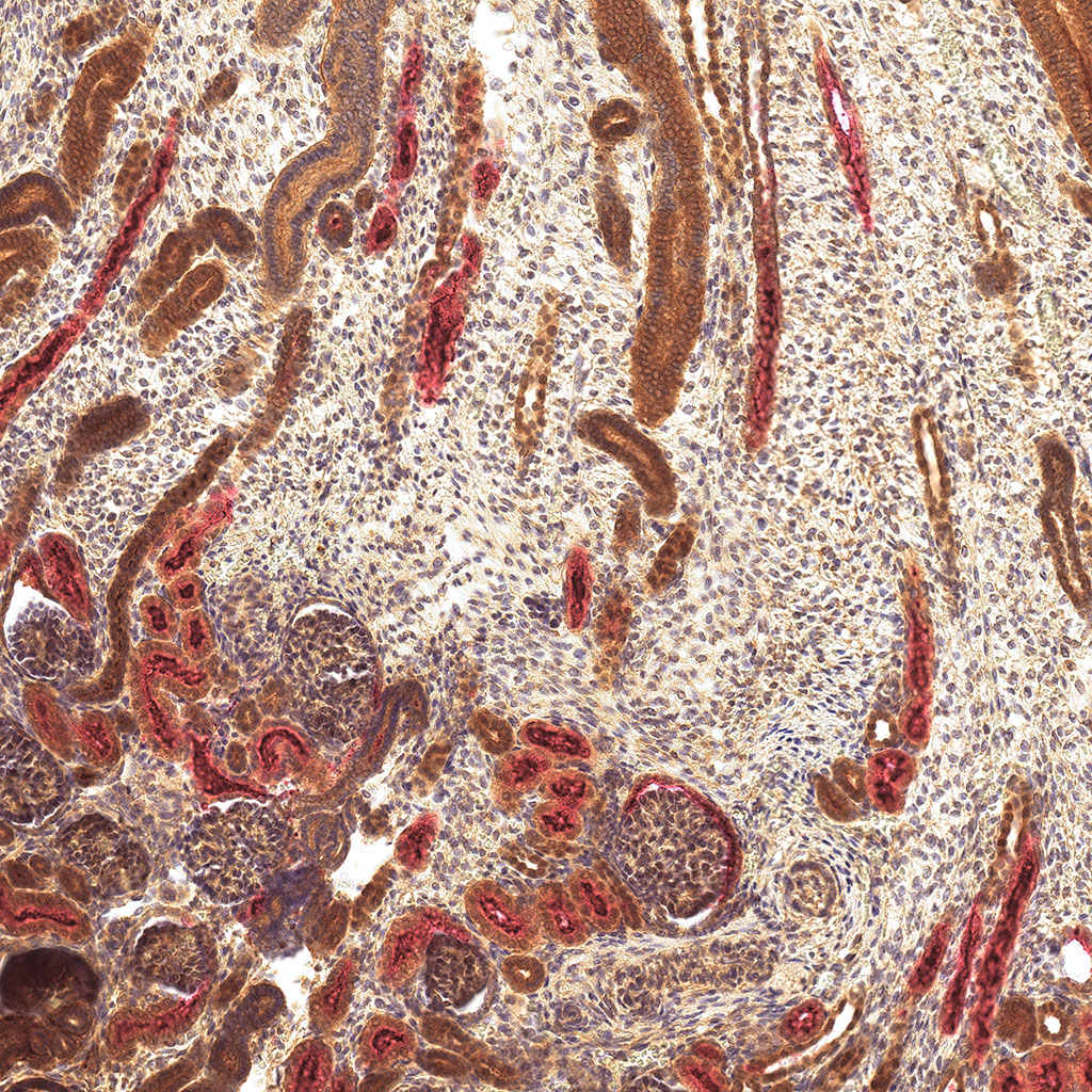 sars-cov-2 gene expression in a human fetus